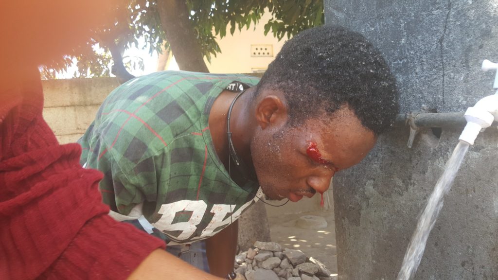 A resident of Mufakose cleans his bloody face after being beaten by police (Pic Elias Mambo)