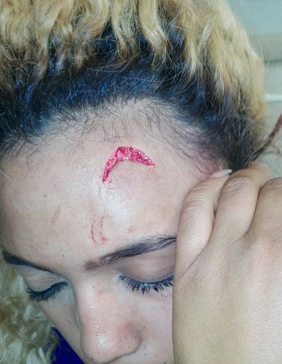 Grace Mugabe assaulted me: Joburg woman