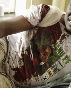 One of the dead victims of bomb blast named