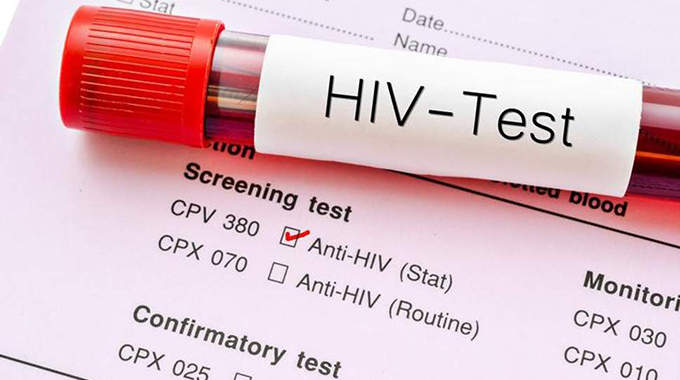 Critical issues on mandatory HIV testing of couples