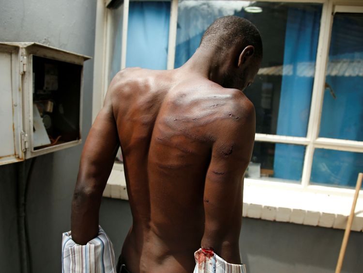 An arrested injured man is seen at a hospital following protests in Harare