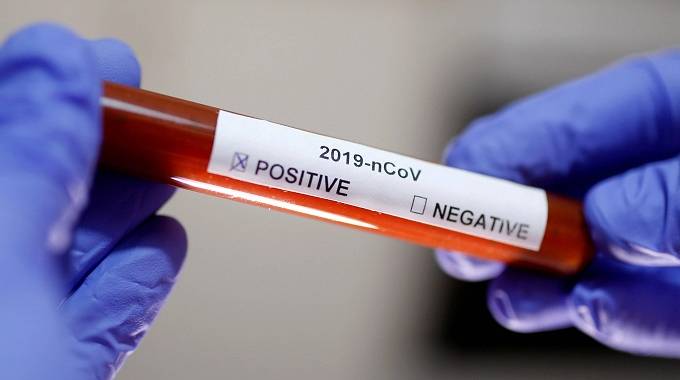 32 new Covid-19 cases recorded