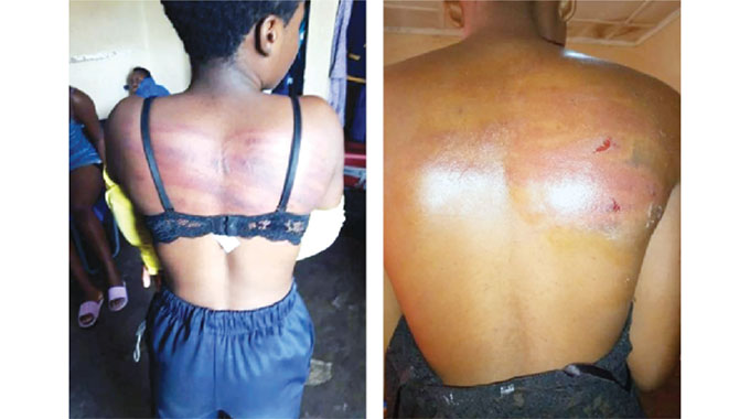 School under probe for brutal assault on pupils