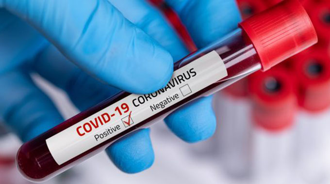 47 die of Covid-19 in 24 hours