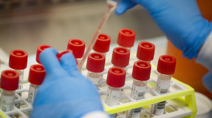 COVID-19: Cases decline in Mash Central