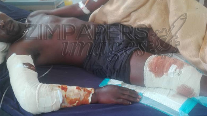 Kariba crocodile attack survivor re-admitted