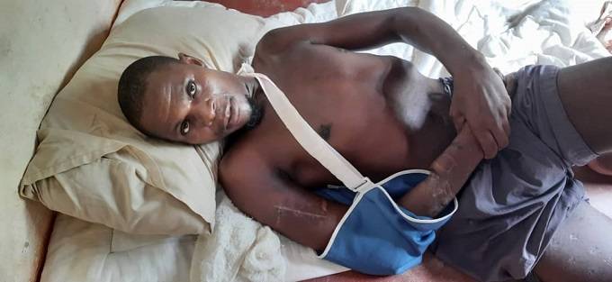 Croc attack survivor stuck in Zambian hospital due to medical bill